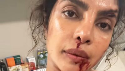 Priyanka Chopra flaunts bruises she sustained during shoot in The Bluff BTS