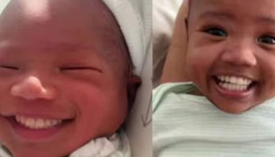 Woman Shares Clip Of Her Baby Born With Teeth, Raises Awareness On This Medical Condition - News18