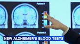 Blood tests for Alzheimer's may be coming to your doctor's office. Here's what to know