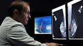 Risks of mammograms may outweigh benefits for some women over 70