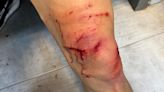 Impactante: así quedó la pierna de Mazzantti luego del patadón de Campi