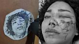 Se tatúa rostro "desfigurado" de Paola Suárez
