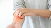 Coexistence of psoriatic arthritis, atopic dermatitis may offer treatment insights