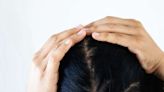 4 Types of Dandruff, Plus the Best Shampoos to Treat Them