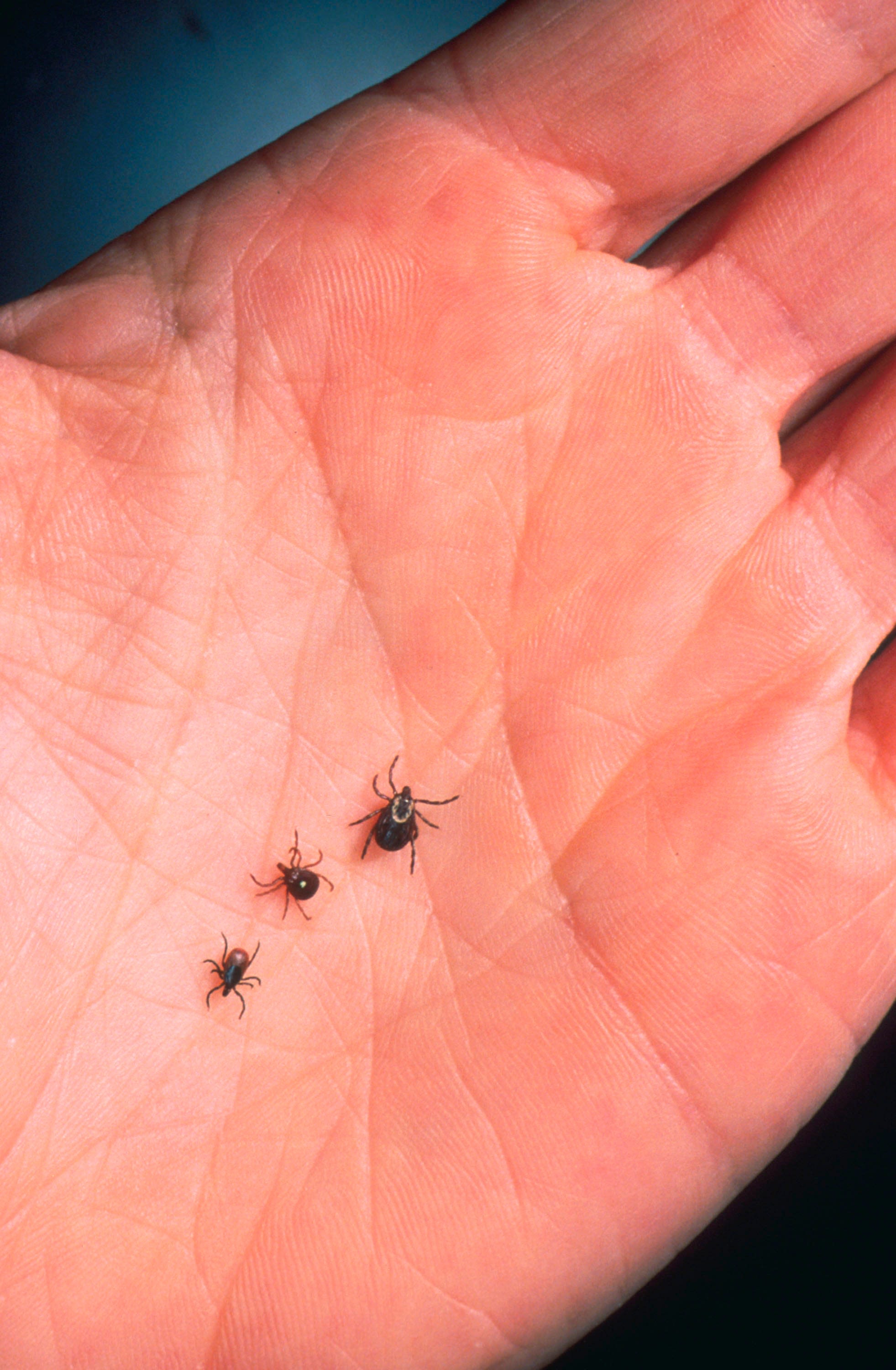 Lyme disease is becoming a bigger problem. Which states have the most cases?