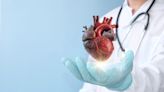 Caristo touts study showing accuracy of its CaRi-Heart technology