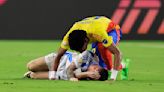 Increíble: así quedó el tobillo de Lionel Messi luego de la final contra Colombia