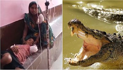 Shameful! Brave Boy Loses Hand Fighting Crocodile In UP's Lakhimpur Kheri, Hospital Treats Child On Bench; Watch Video