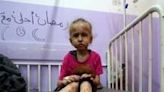 A Palestinian child waits for treatment at Al-Aqsa Martyrs Hospital in Deir al-Balah in the central Gaza Strip on May 30, 2024