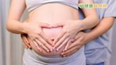 孕婦染疫母嬰雙亡 醫以7觀點鼓勵：隧道盡頭是陽光