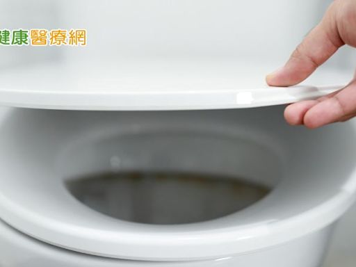 從大便顏色了解腸胃道疾病 4顏色是「警訊」快自我檢視！ | 蕃新聞