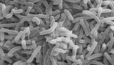 Persistent strain of cholera defends itself against forces of change, scientists find
