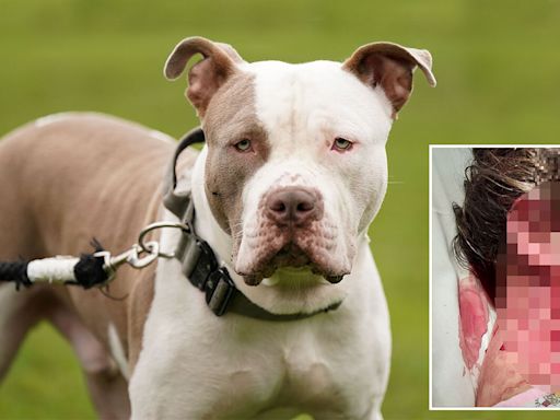 'Banning breeds doesn't protect people' says charity after girl, 10, attacked by XL bully