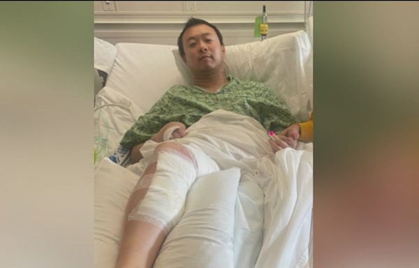 Juneteenth Lake Merritt shooting victim loses finger, suffers life-changing injuries