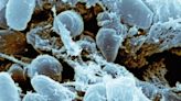 The plague rarely affects humans, though the US sees about 7 cases a year. Here's why - ET HealthWorld