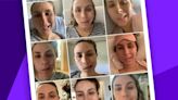 Women share what it's like to have facial paralysis from Bell's palsy: 'This is not my face'