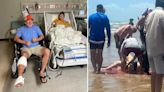 Woman's calf torn off by shark after she thought it was a fish and kicked it