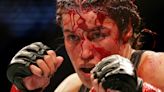 Dana White: Julianna Peña lost ‘big chunk’ of forehead at UFC 277, needs surgery