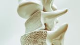 Could Getting Enough Sleep Help Prevent Osteoporosis?