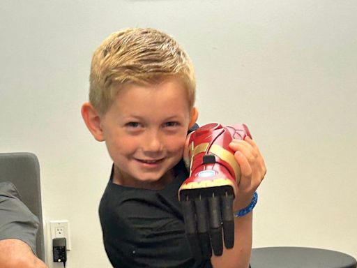 Boy, 5, is world’s youngest to use bionic hero arm