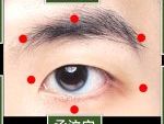 青光眼年輕化趨勢 中醫針灸助緩解