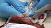 Universal Donor Blood Is A Step Closer Thanks To Enzyme Discovery