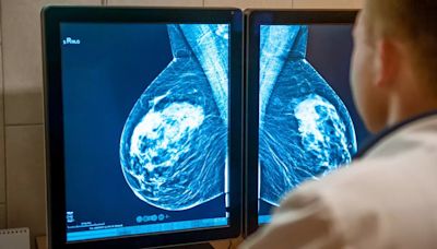 Breast Cancer Awareness Month: THESE Tests Can Help In The Detection Of The Cancer