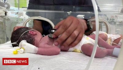 Guerra Israel-Hamas: a bebê de Gaza retirada viva do ventre da mãe morta após ataque