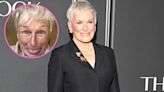 Glenn Close Shows Off Bruised Face After Breaking Her Nose: ‘Feeling as Beautiful as Ever’
