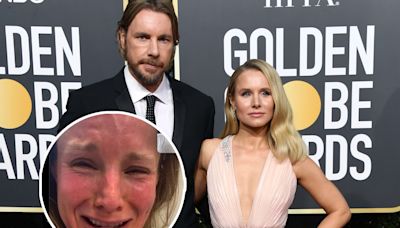 Dax Shepard Shares Video of Kristen Bell 'Gassed' On Nitrous at Dermatologist