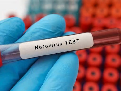 Köln: Norovirus-Fälle steigen drastisch – RKI warnt