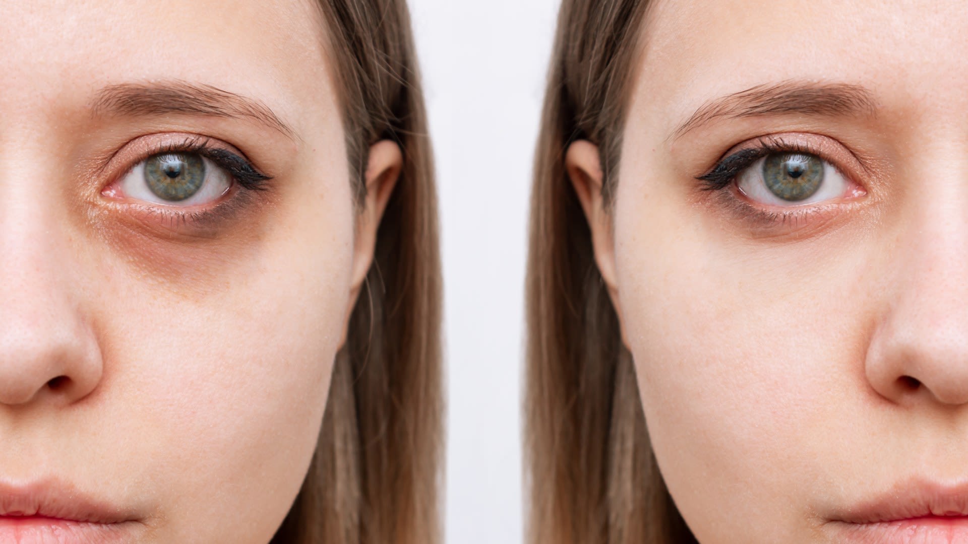 Shoppers rave over Superdrug buy for dark circles & you’ll get change from £5