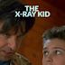 The Kid with X-ray Eyes