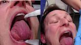 This Belgium Man Has The Largest Tongue Circumference In The World - News18