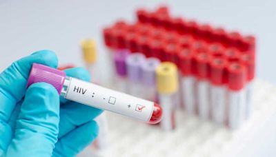 Twice-a-year anti-HIV injection shows 100 per cent efficacy, reveals study