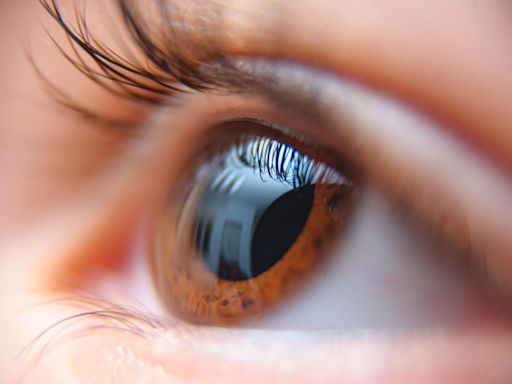 什麼是「葡萄膜炎」？為何癌藥會引發此眼疾？眼科醫：即時診斷治療能避免失明