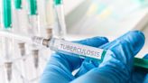 Tuberculosis Vaccine: In the United States and Around the World
