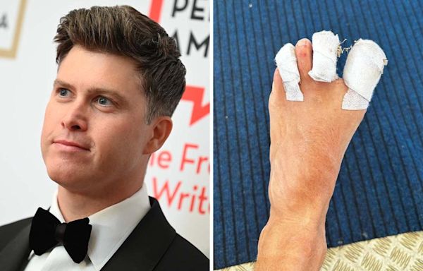 Colin Jost suffers staph infection after Olympics surfing injury: "This might ruin my WikiFeet score"