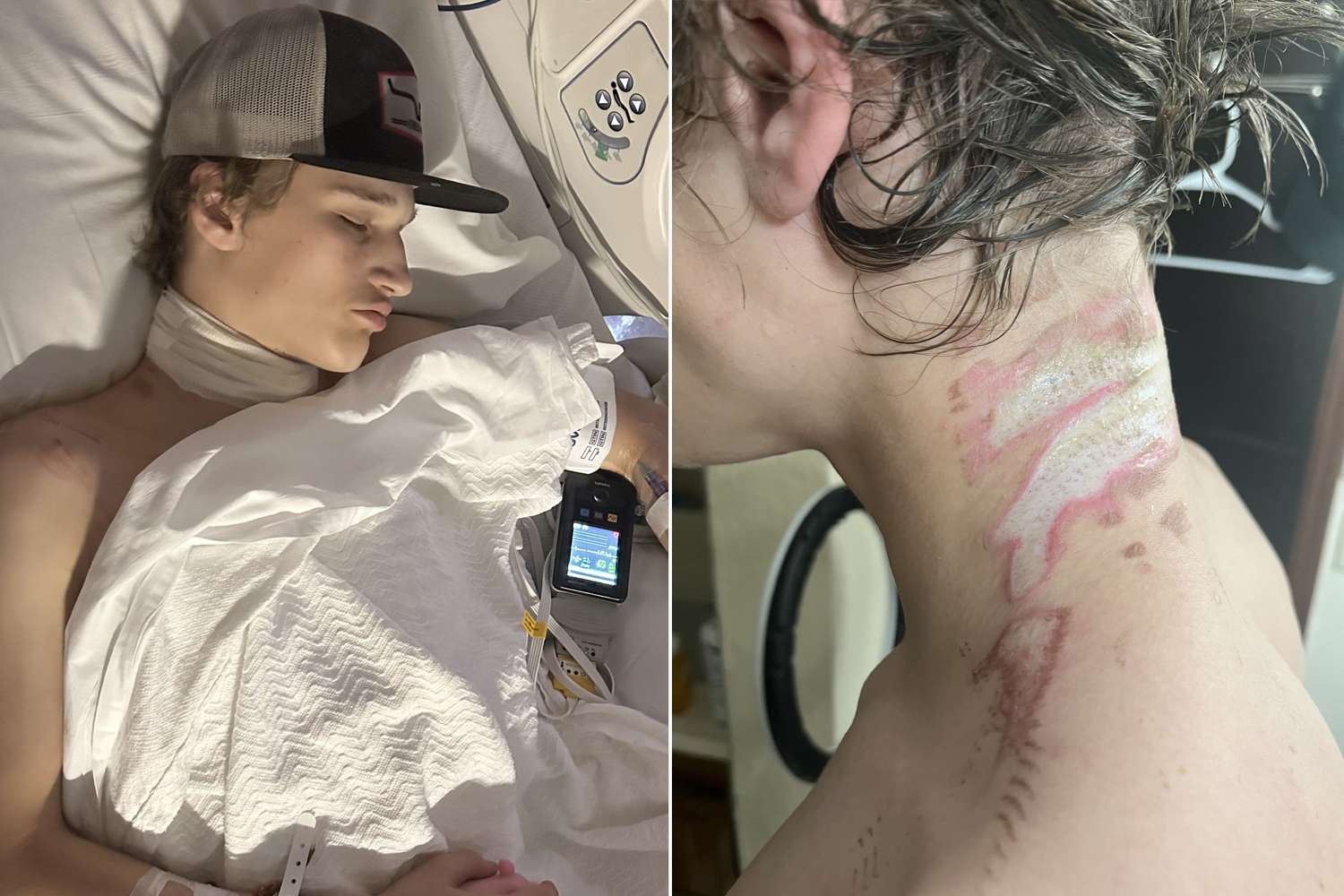 16-Year-Old Electrocuted by His Necklace in Freak Accident: 'It Was Like a Hot Coil'