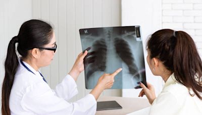 健康網》肺部檢查發現白點是罹癌？醫：大於3公分恐是惡性 - 自由健康網