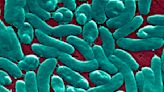 CDC warns of rare bacterial infection that has claimed the lives of a dozen Americans