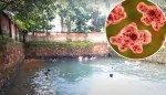 Brain-eating amoeba kills teen after he went swimming in contaminated water — third death in 2 months