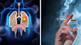 It's Not Just Smoking - Shocking Myths About Lung Cancer Debunked