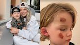 Witney Carson Shares Update on Son Leo's Healing After Scary Fall and E.R. Trip: 'Grateful It Wasn't Worse'