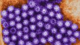 Norovirus outbreak sparks 'strict hygiene' warning amid 'alarmingly high' cases
