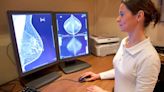 Un panel de expertos de EE.UU. recomendó las mamografías a partir de los 40 años