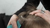 How Is Lice Treated?