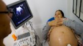 Minsa: cifras de muerte materna disminuyen este año respecto al mismo periodo del 2023