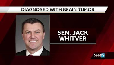 Iowa Senate Majority Leader Jack Whitver diagnosed with brain tumor
