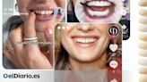 'Sonrisas Hollywood' con carillas y ortodoncias 'low cost': qué hay tras la obsesión por unos dientes hiperalineados
